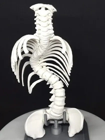 3D列印代工：FDM 列印的脊椎骨骼模型
